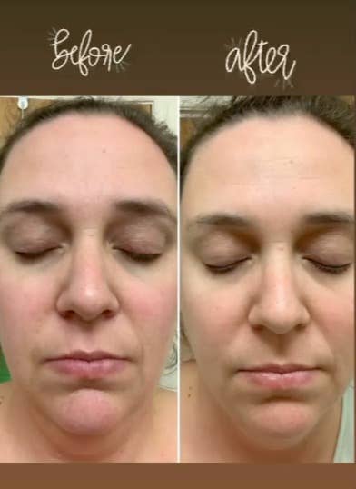 Hello Glow Face Mask | Skin Care | Facial Mask for Women - Serene Beauty